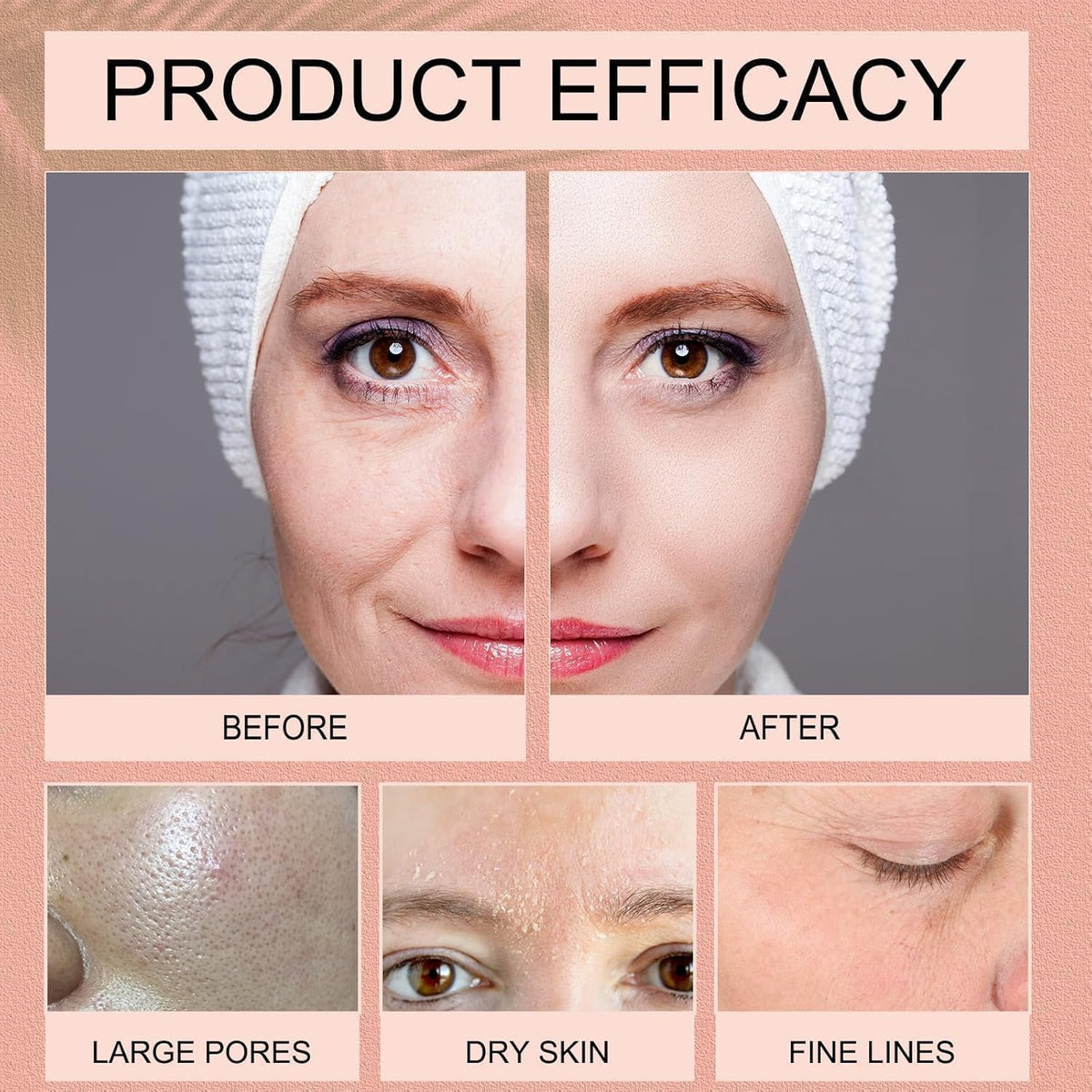 Medicube Bio Collagen Face Mask Overnight, Bio Collagen Face Mask, Bio Collagen Mask, Hydrating Overnight Hydrogel Mask, Pore Minimizing, Elasticity (Pack Of 1, TUBE 75 gm)